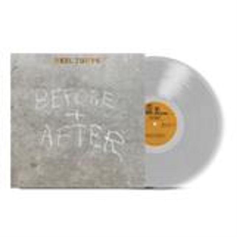 Neil Young-Before and After(LTD)